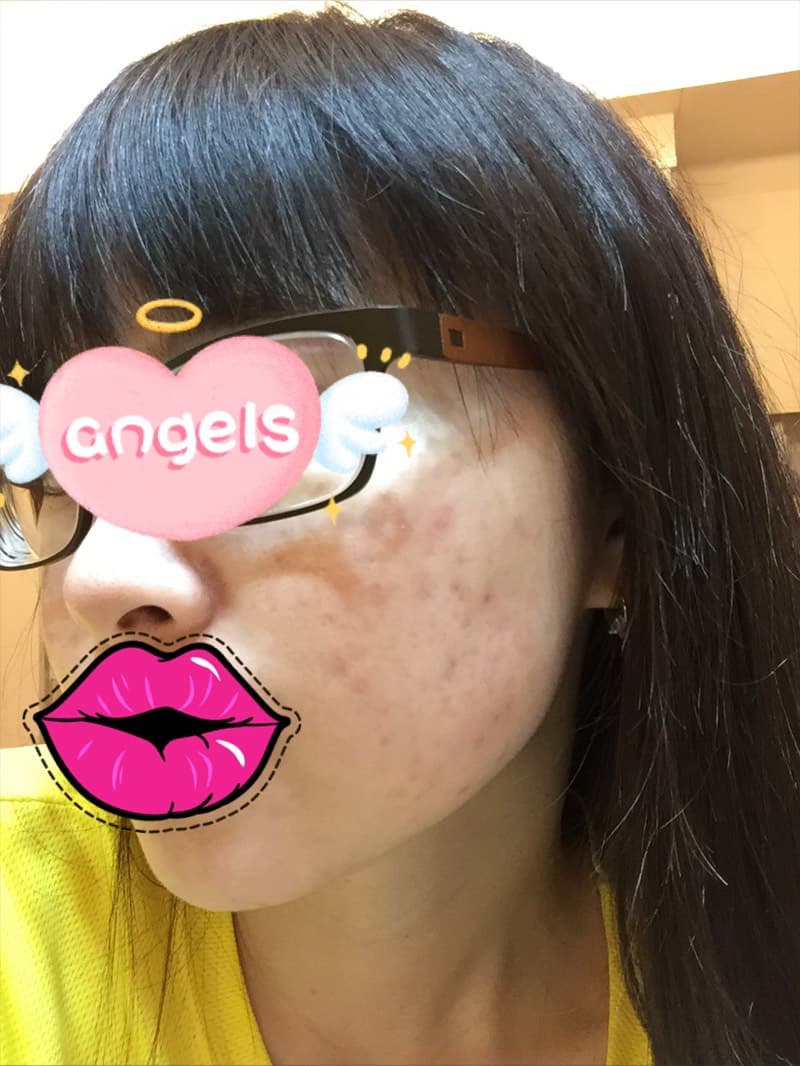 megapx
