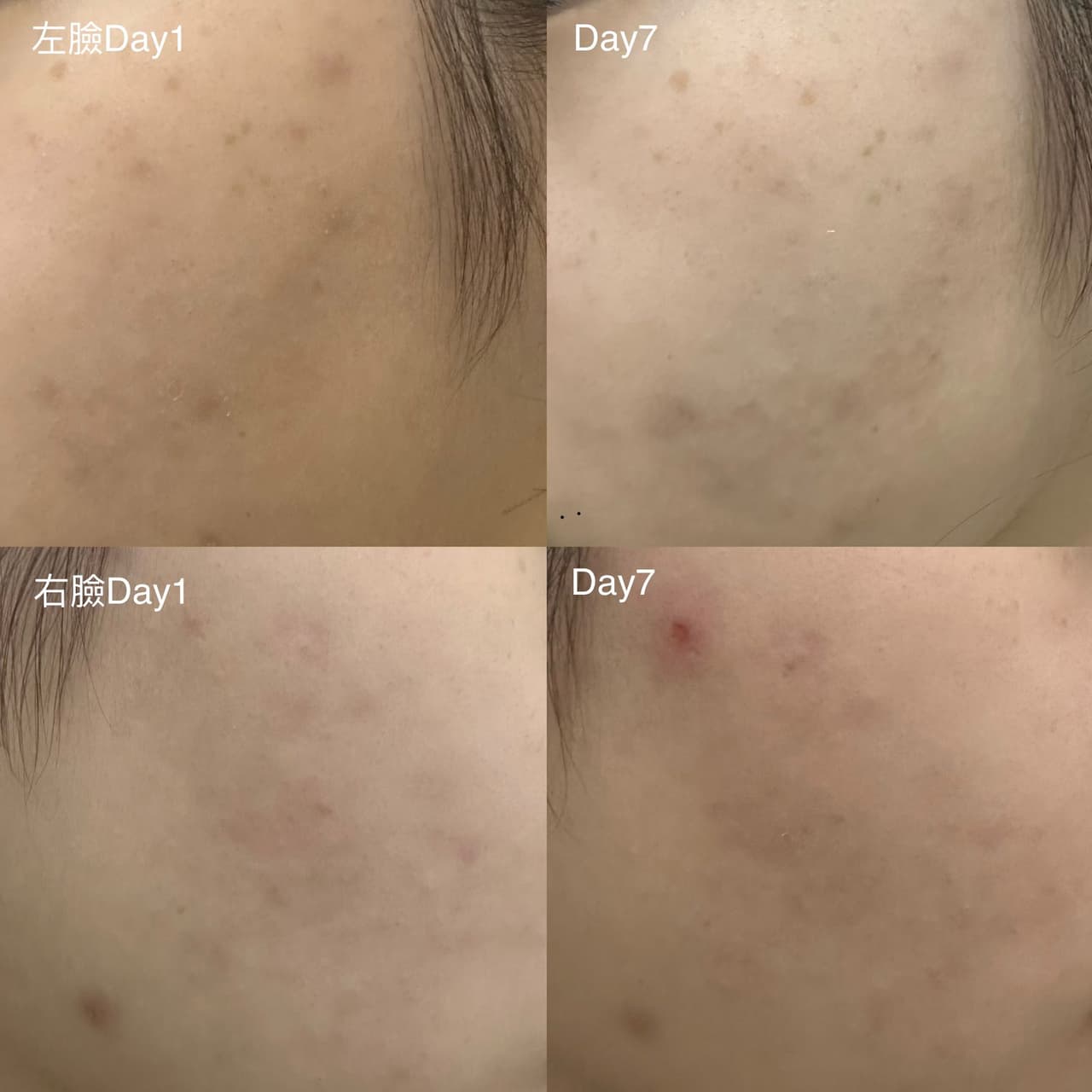 megapx