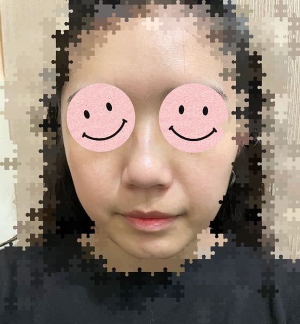 megapx