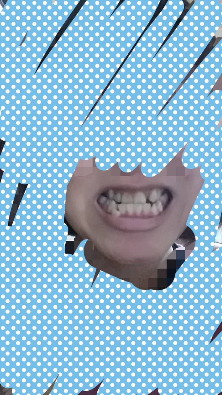 megapx