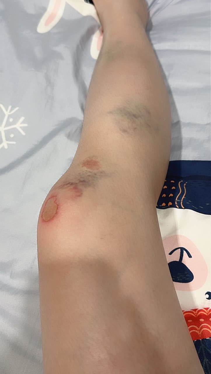 車禍和解的精選文章與討論｜Dcard