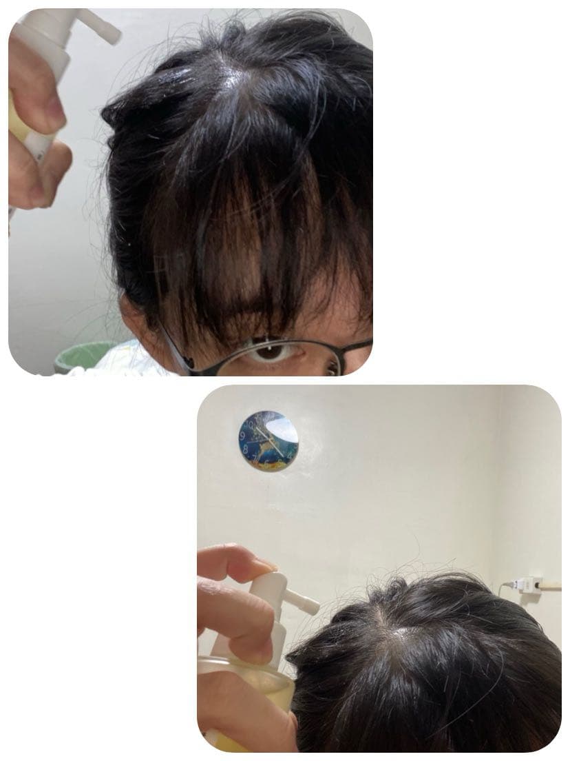 megapx