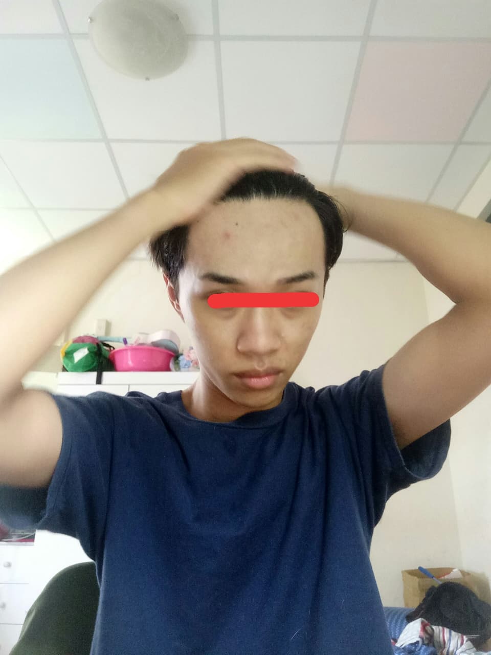 megapx