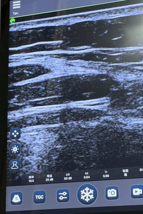 megapx