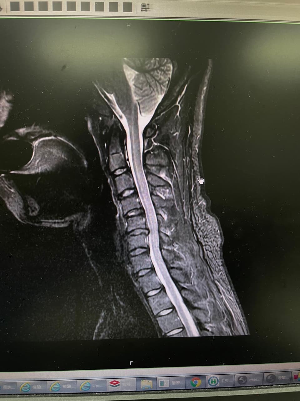 megapx
