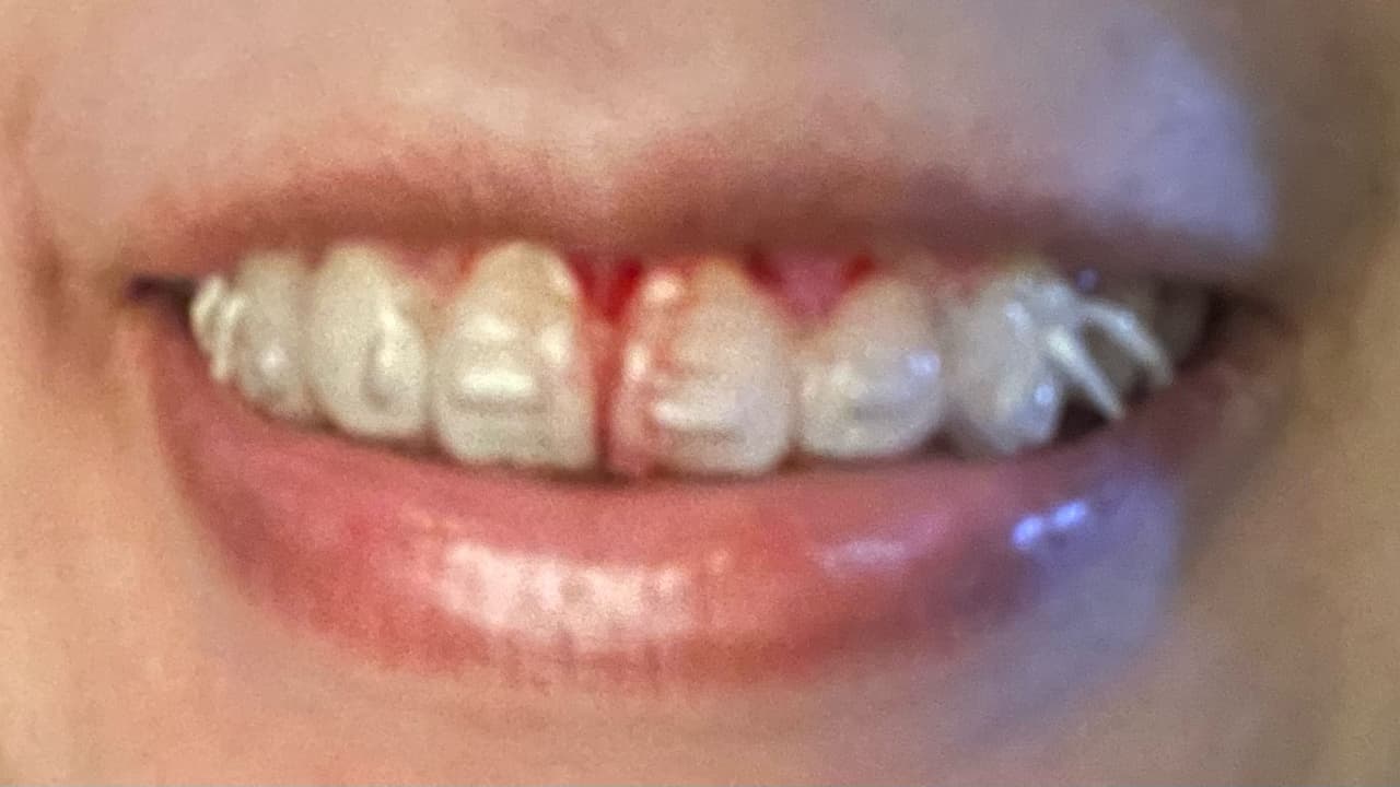 megapx