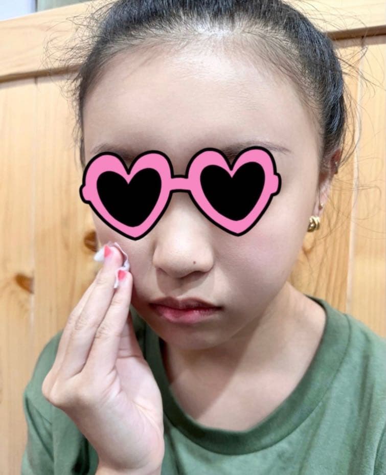 megapx