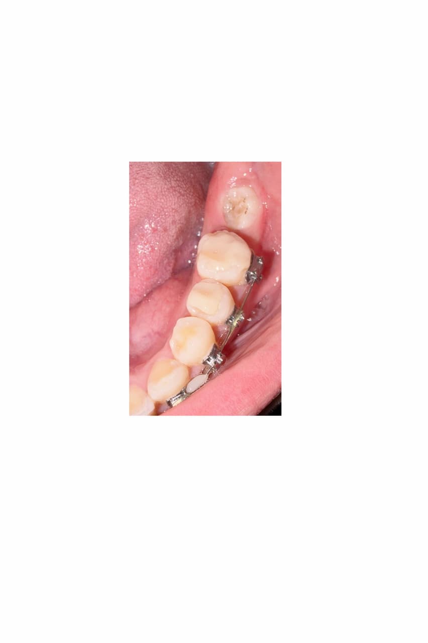 megapx