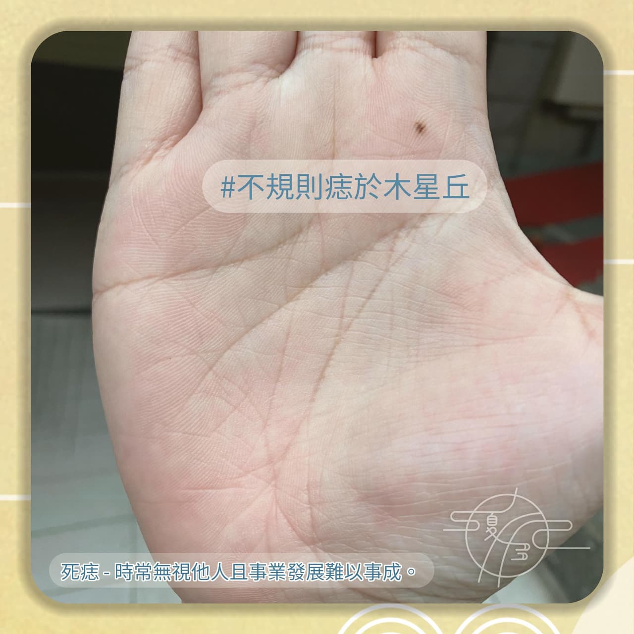 基礎手相教學 - 你手上的痣是活痣還是死痣？ - 手相夏多 (@kshad0w) | Dcard
