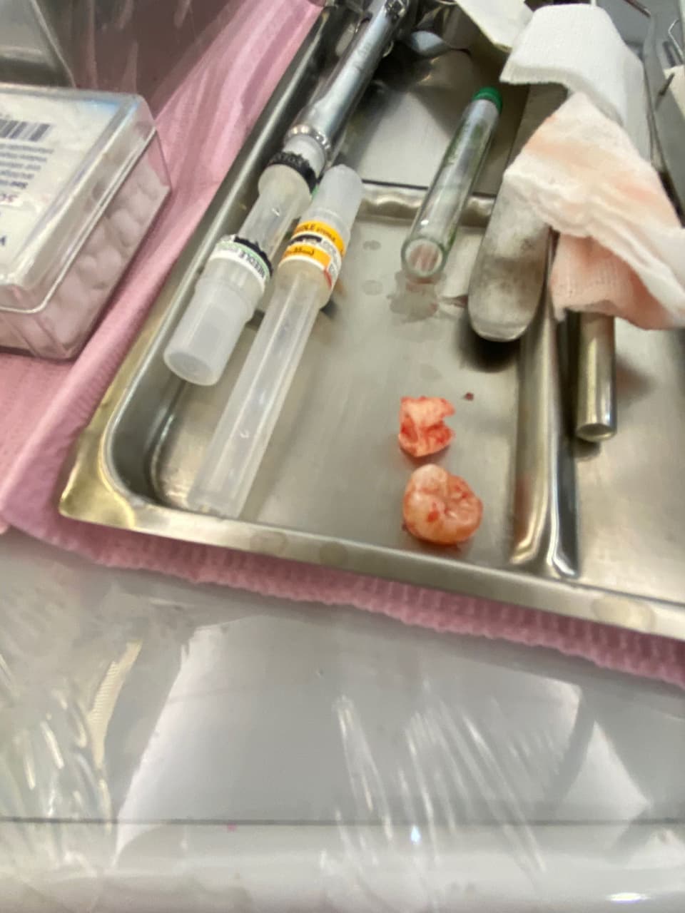 問這樣子你們會拔智齒嗎 牙齒矯正板 Dcard