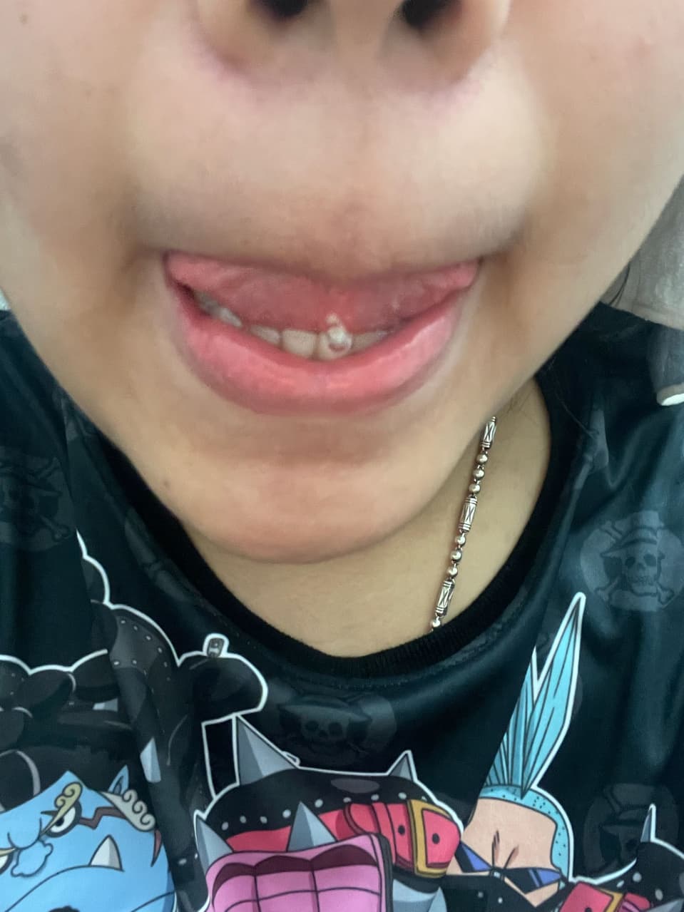 舌環有硬塊 - 女孩板 | Dcard