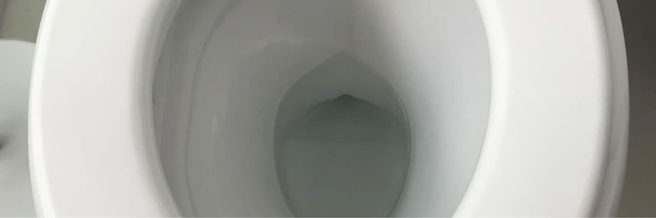 大便忘記沖