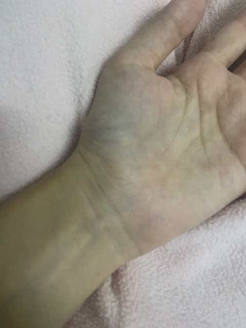 手上出現了一條很對稱的線 - 靈異板 | Dcard