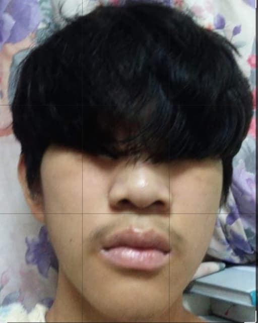 megapx