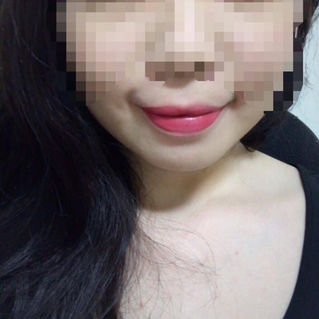 megapx
