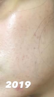 megapx