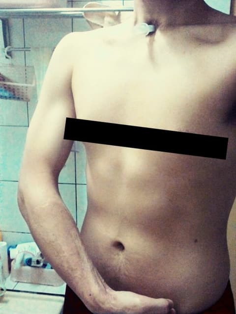 megapx