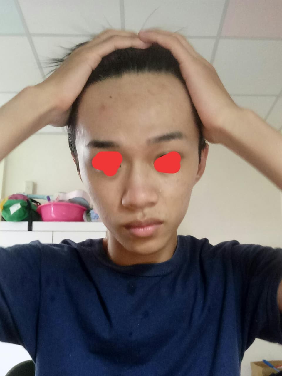 megapx