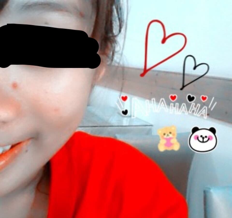 megapx