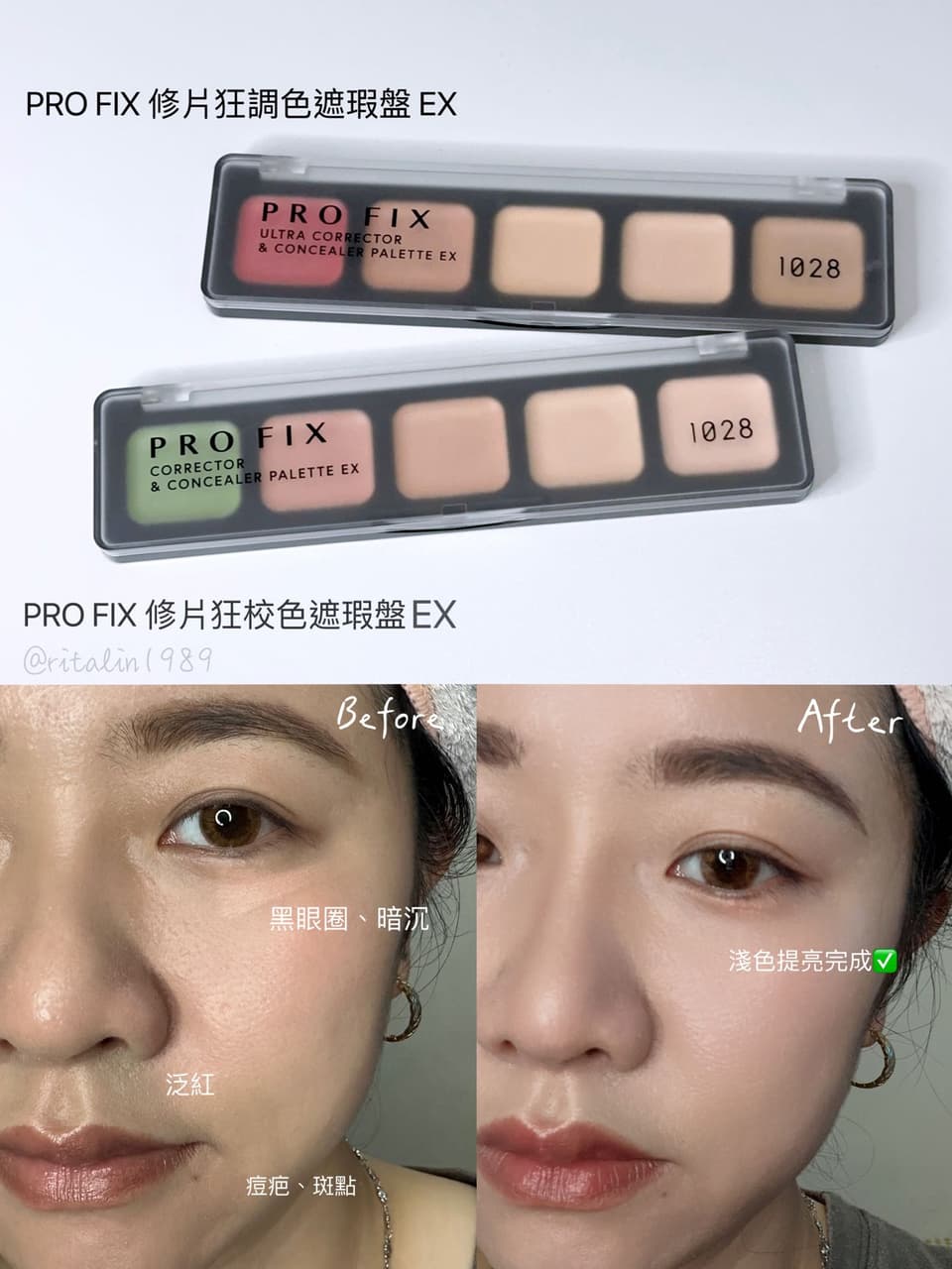 megapx