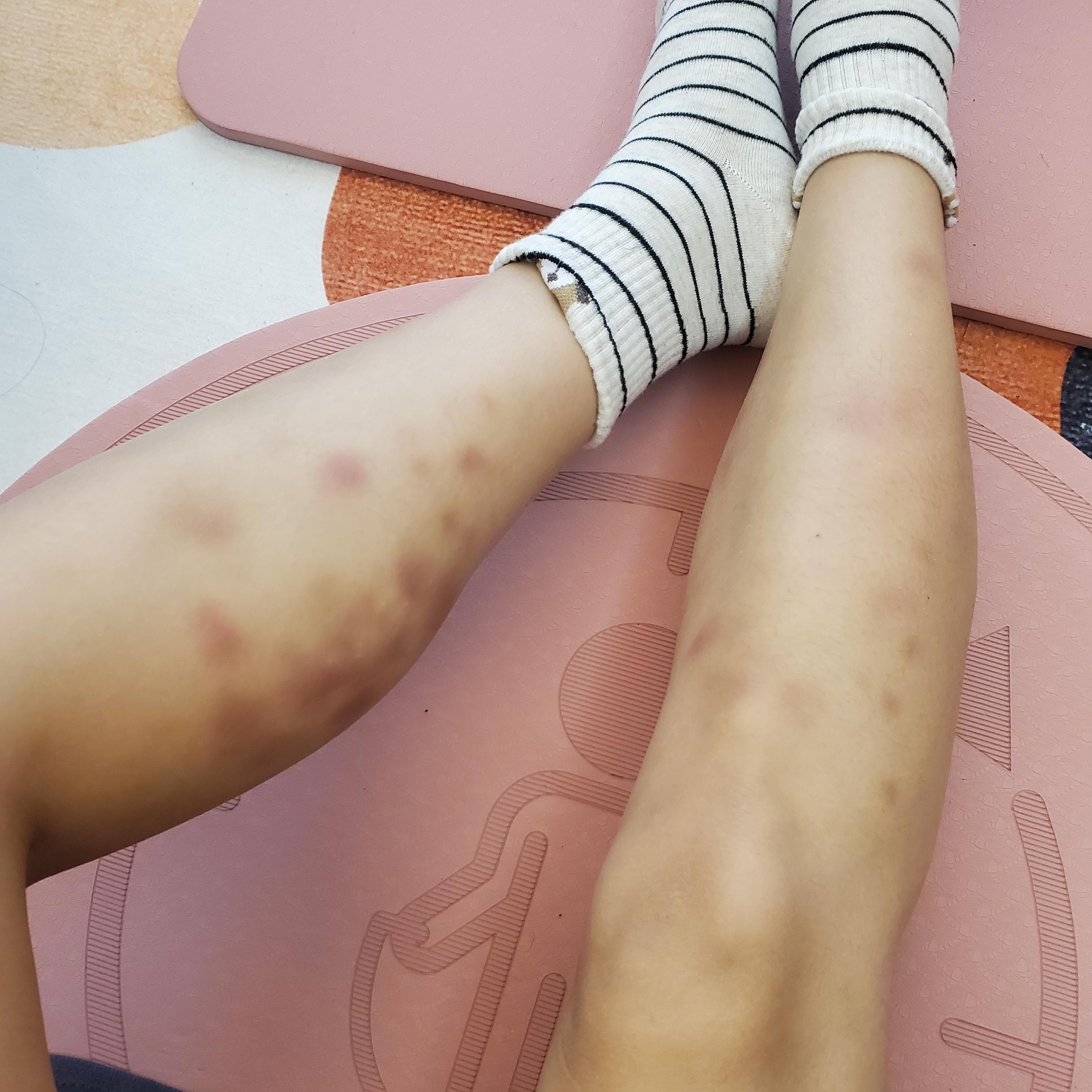 滾輪按摩到瘀青還能繼續跳繩嗎- 健身板| Dcard