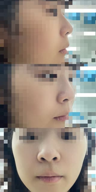 megapx