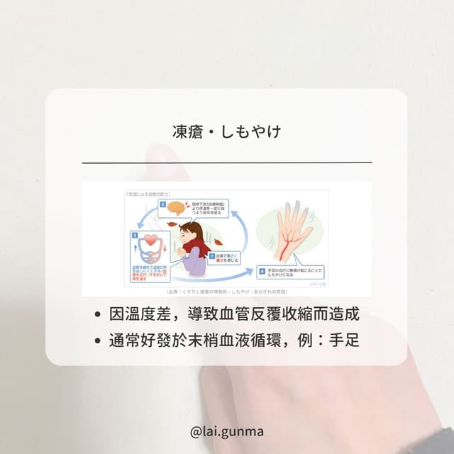 讓我又痛又癢的 #凍瘡 #しもやけ 日本交換留學的生活大小事-2 - 日本生活板 | Dcard