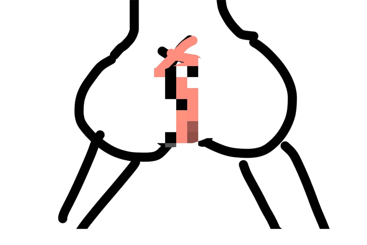megapx
