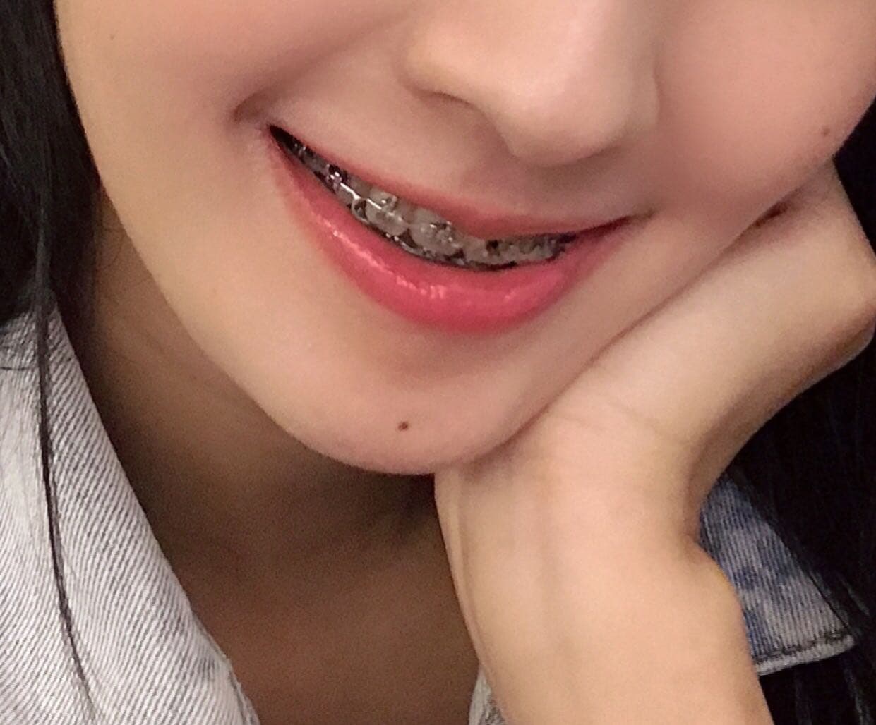 megapx