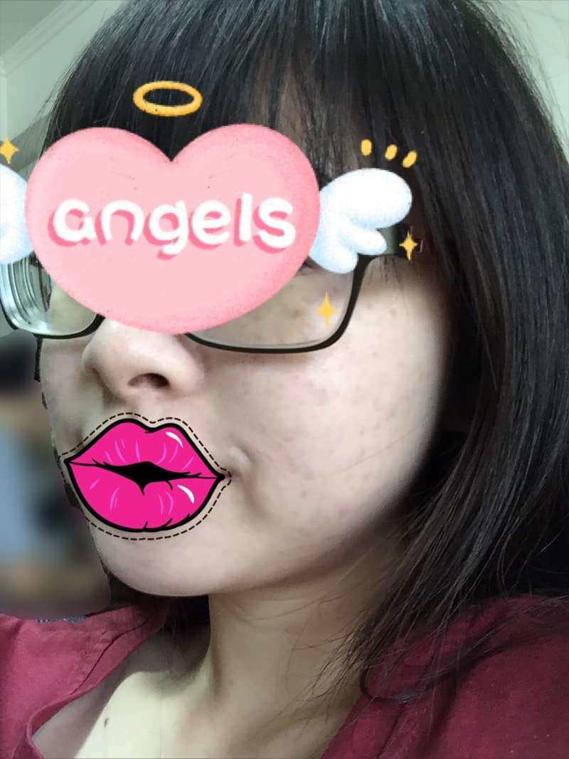 megapx