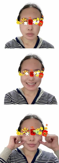 megapx
