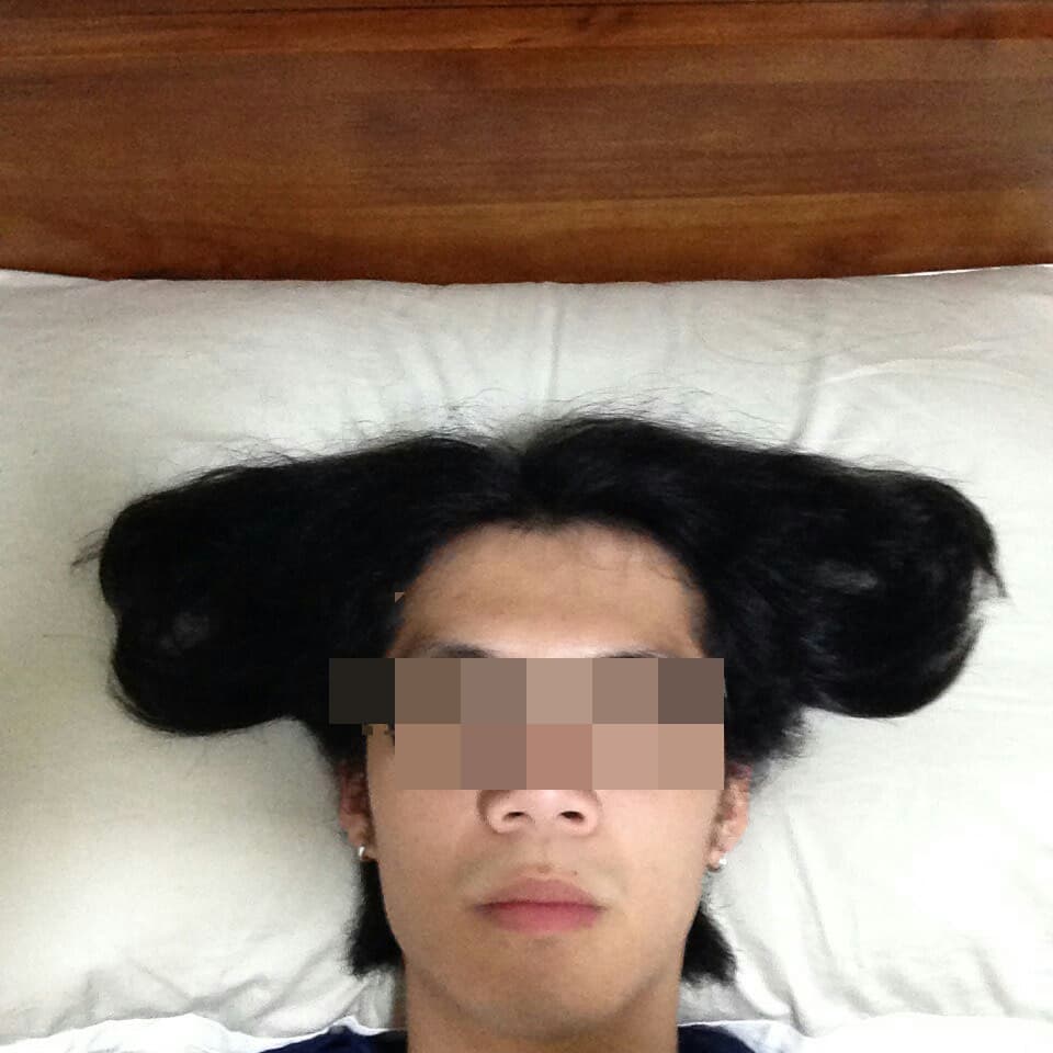 megapx