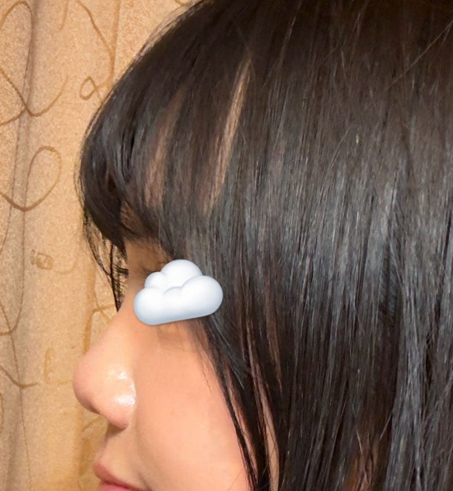 megapx