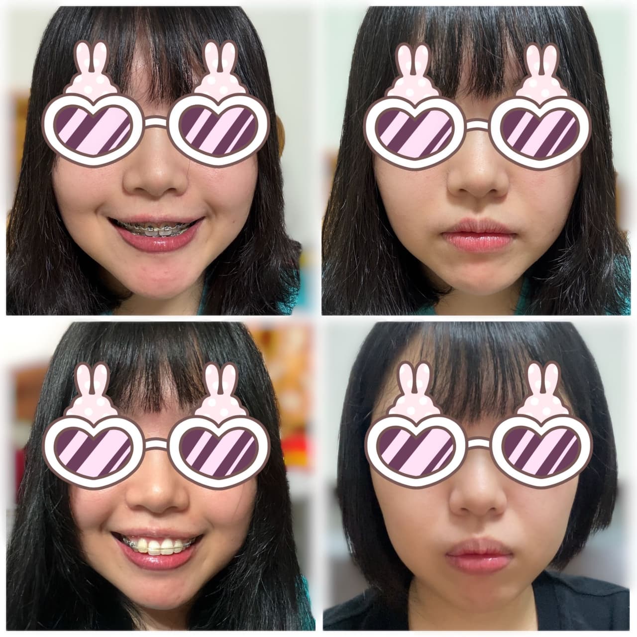 megapx