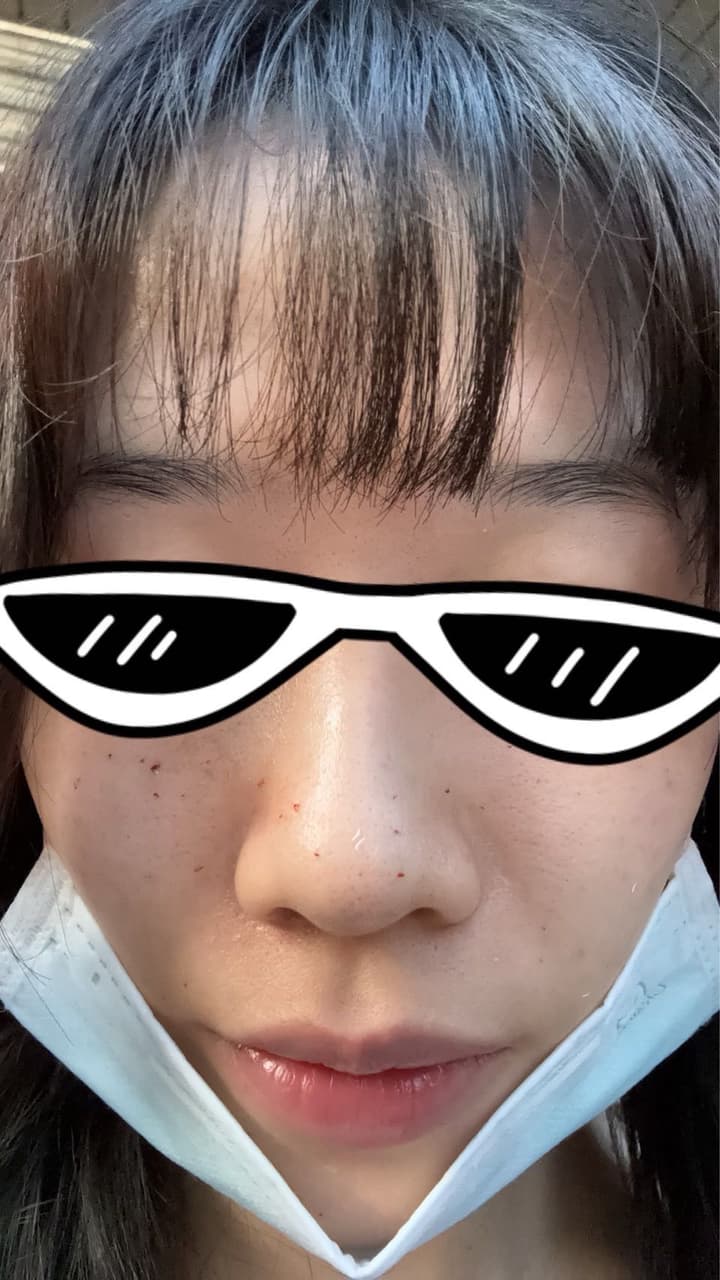 megapx