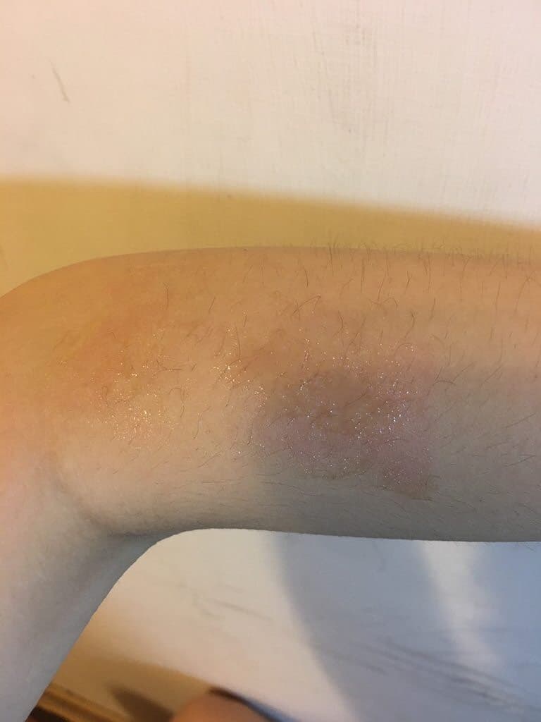 求解貝拉蜜糖蜜蠟除毛- 美妝板| Dcard