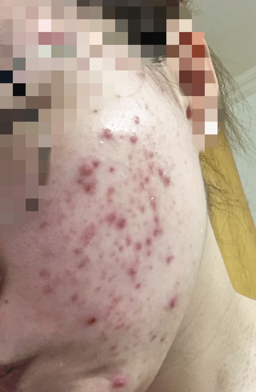megapx