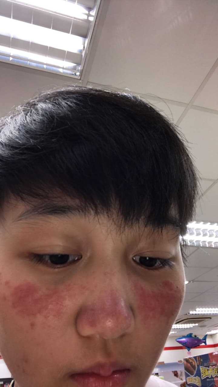 megapx