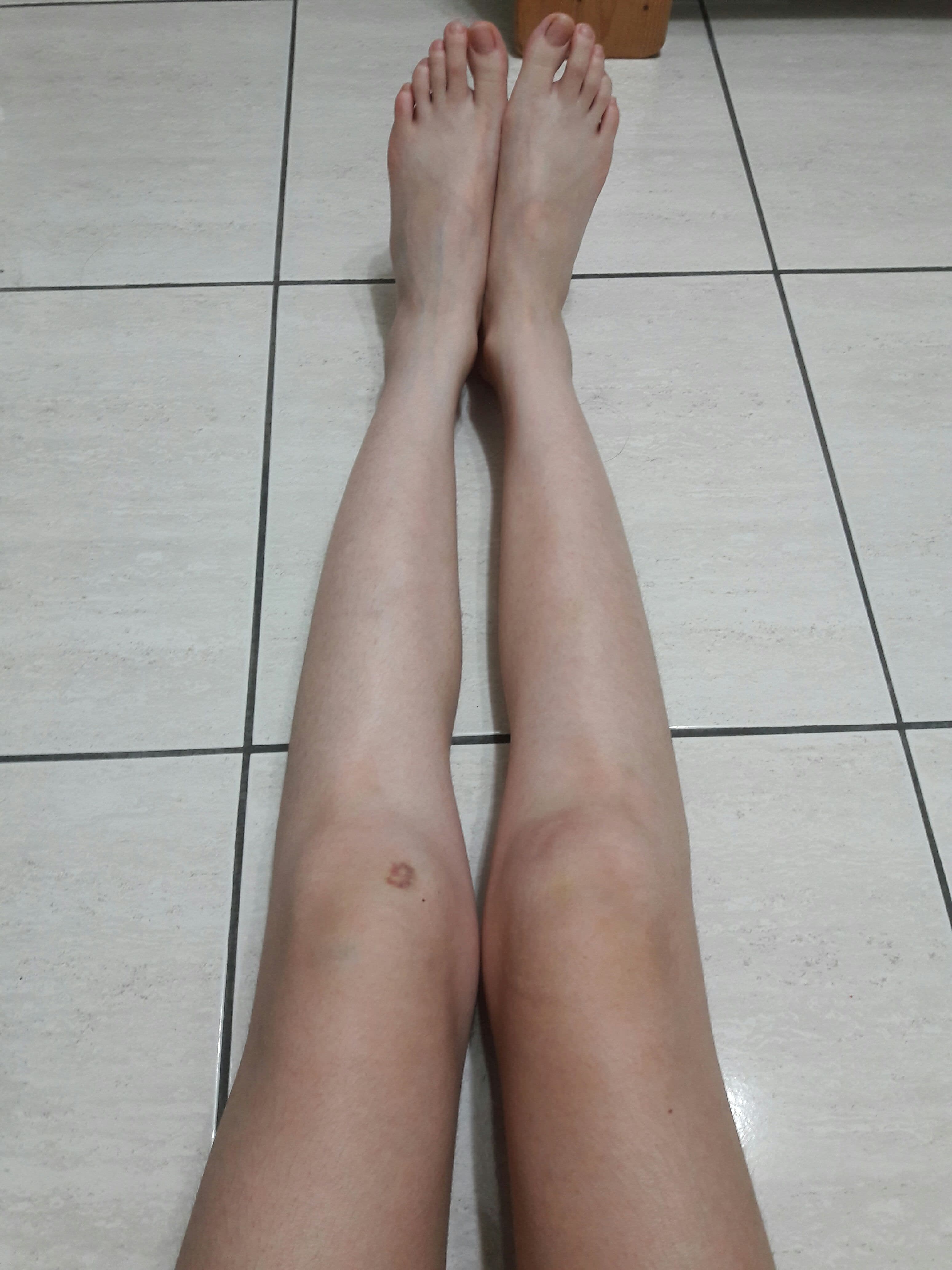 除掉留了23年的腳毛- 女孩板| Dcard