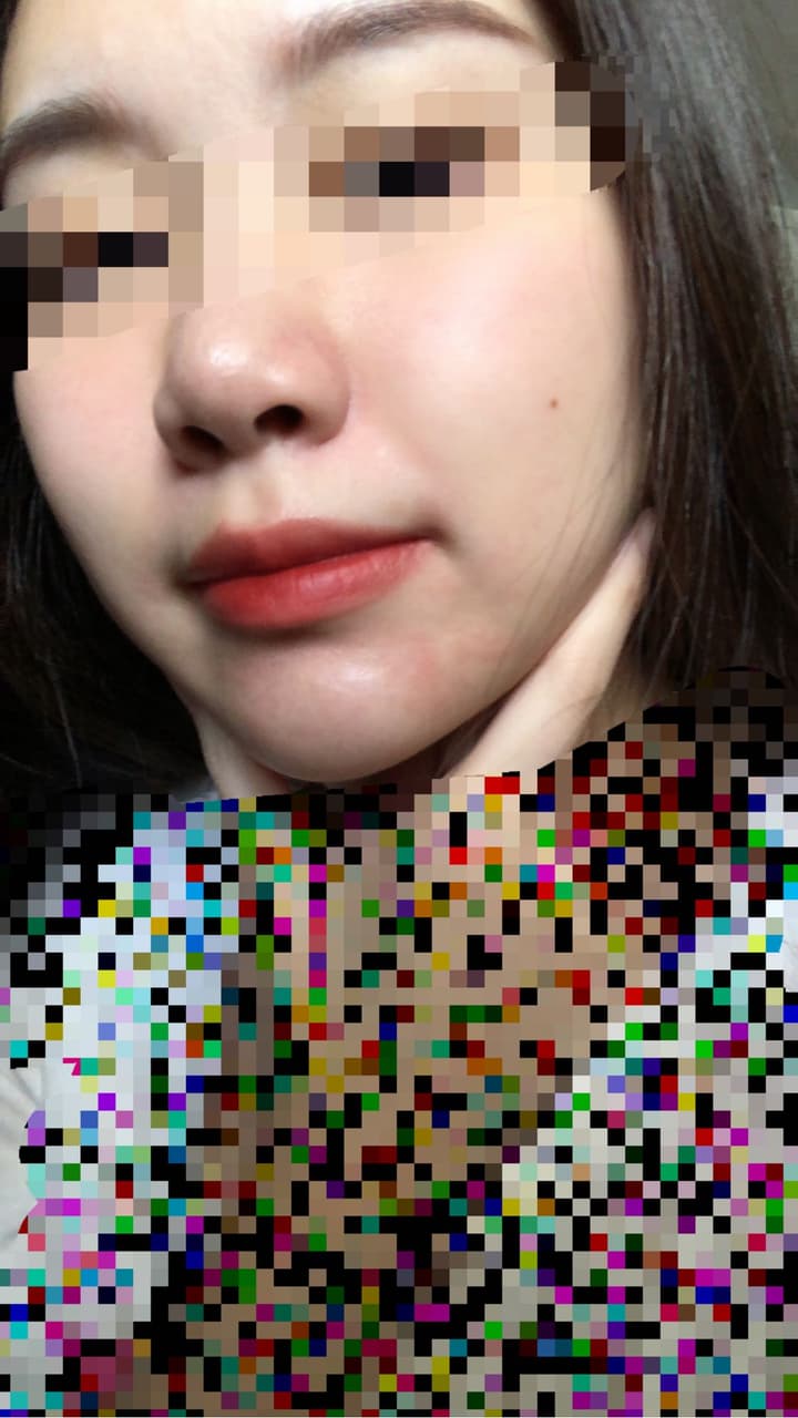 megapx