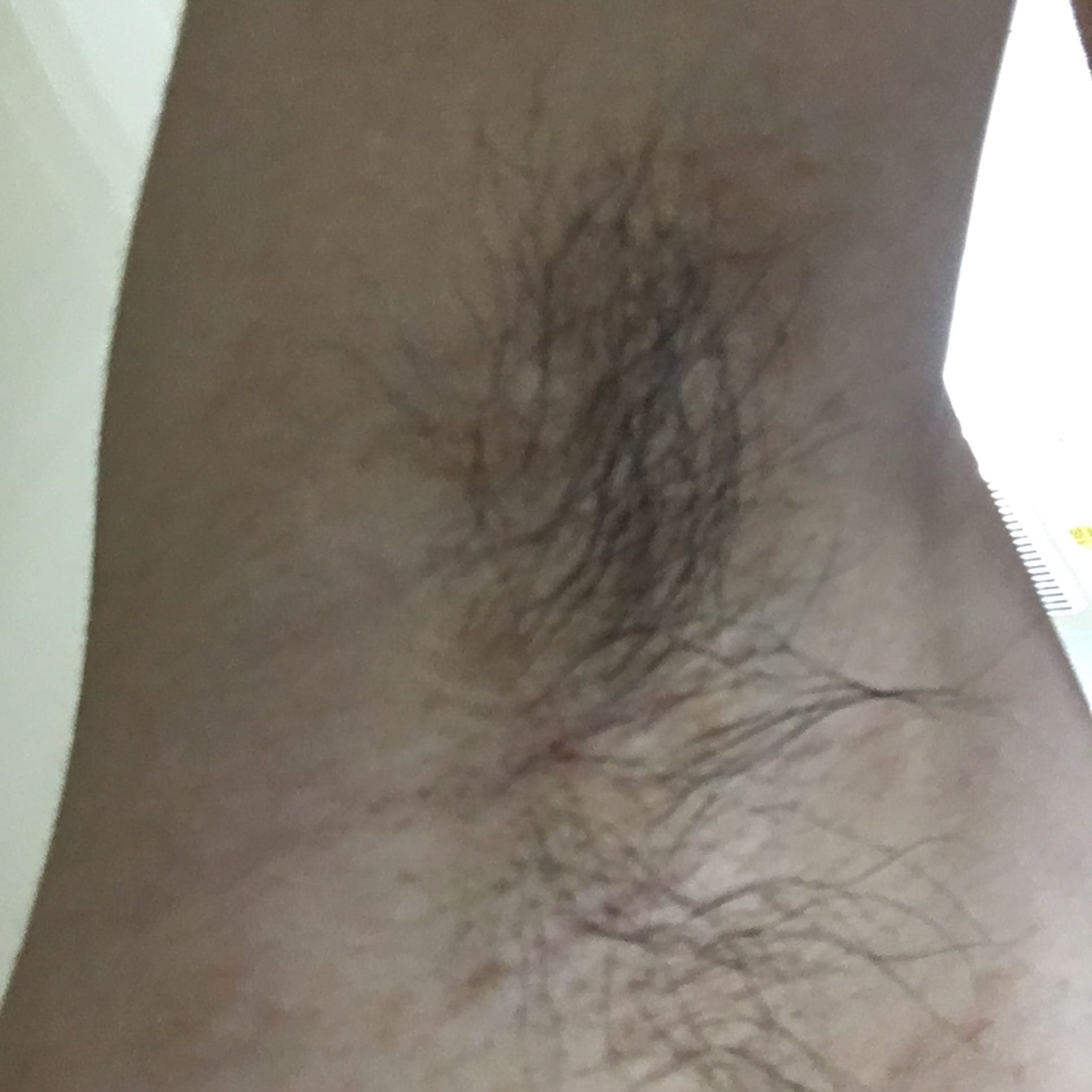 求圖，想看各位姊姊們的腋毛陰毛- 西斯板| Dcard