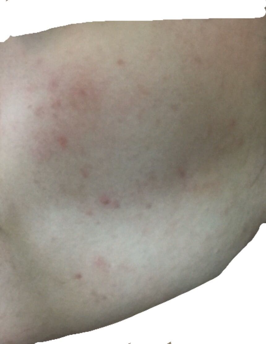 問舒利達的使用 美妝板 Dcard