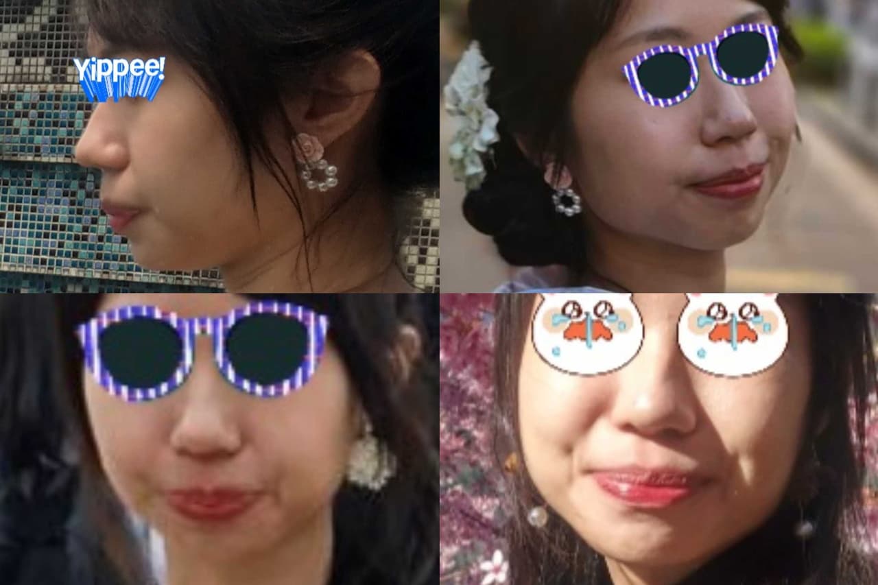 megapx