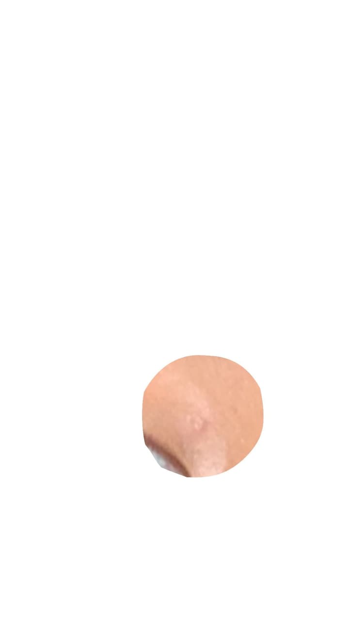 megapx