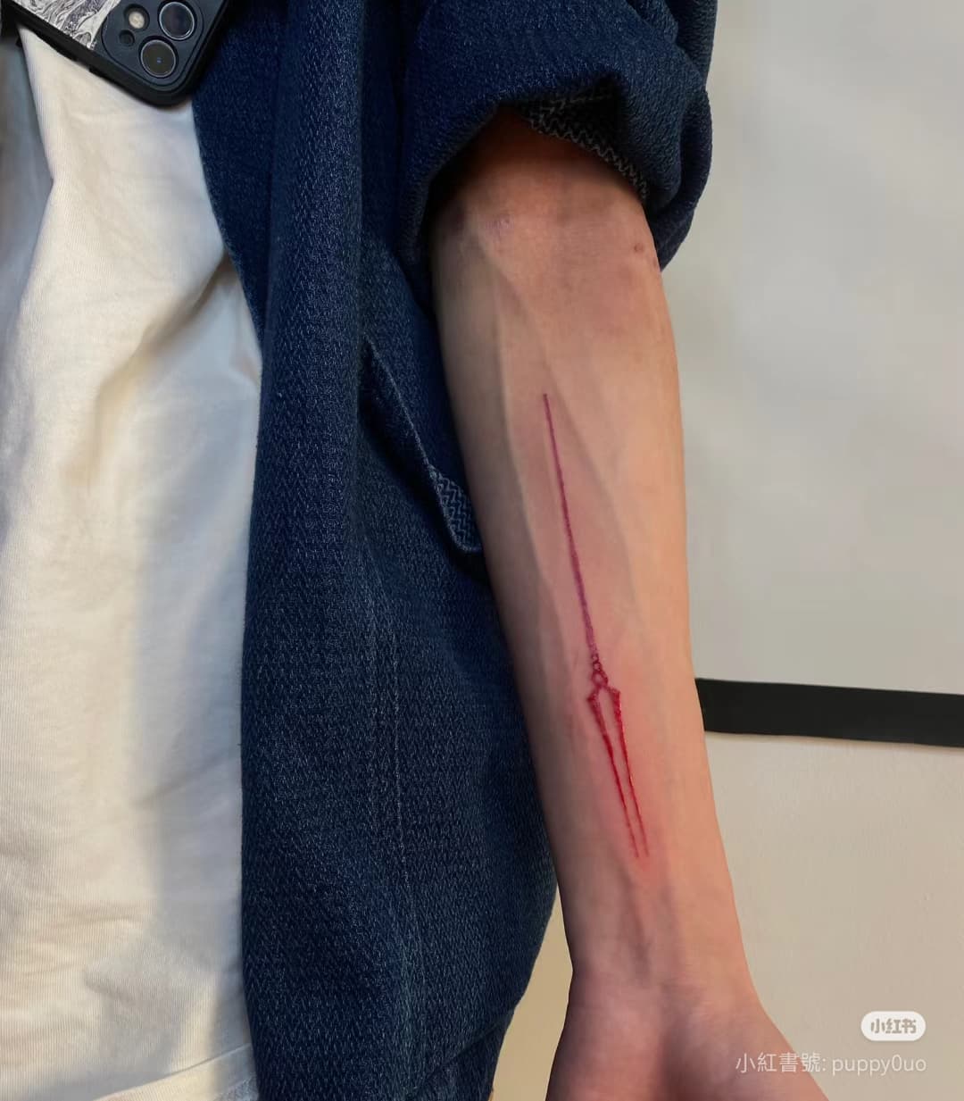 megapx