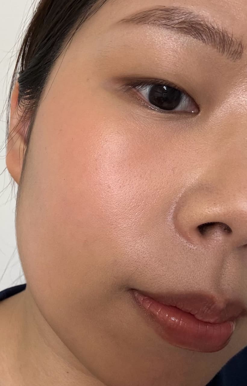 megapx