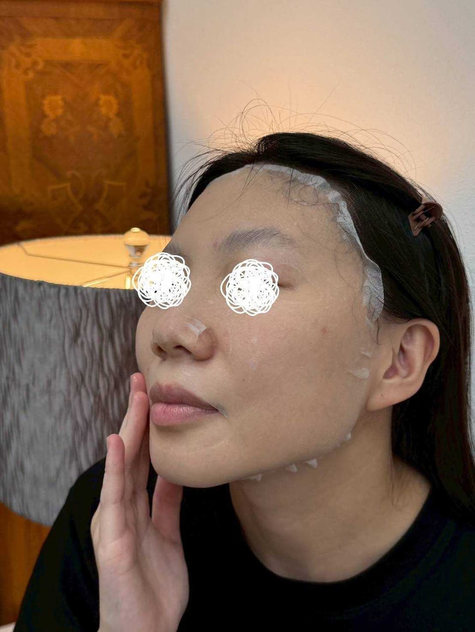 megapx