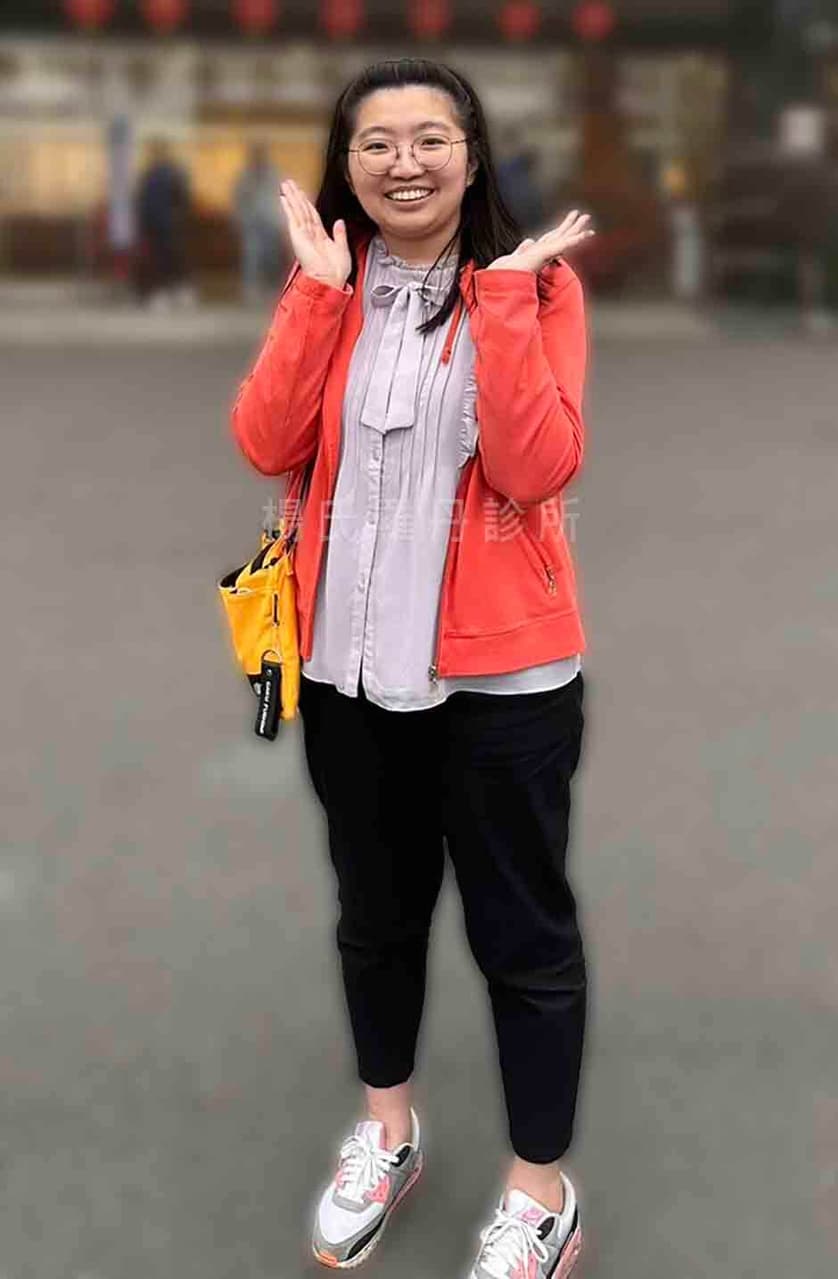megapx