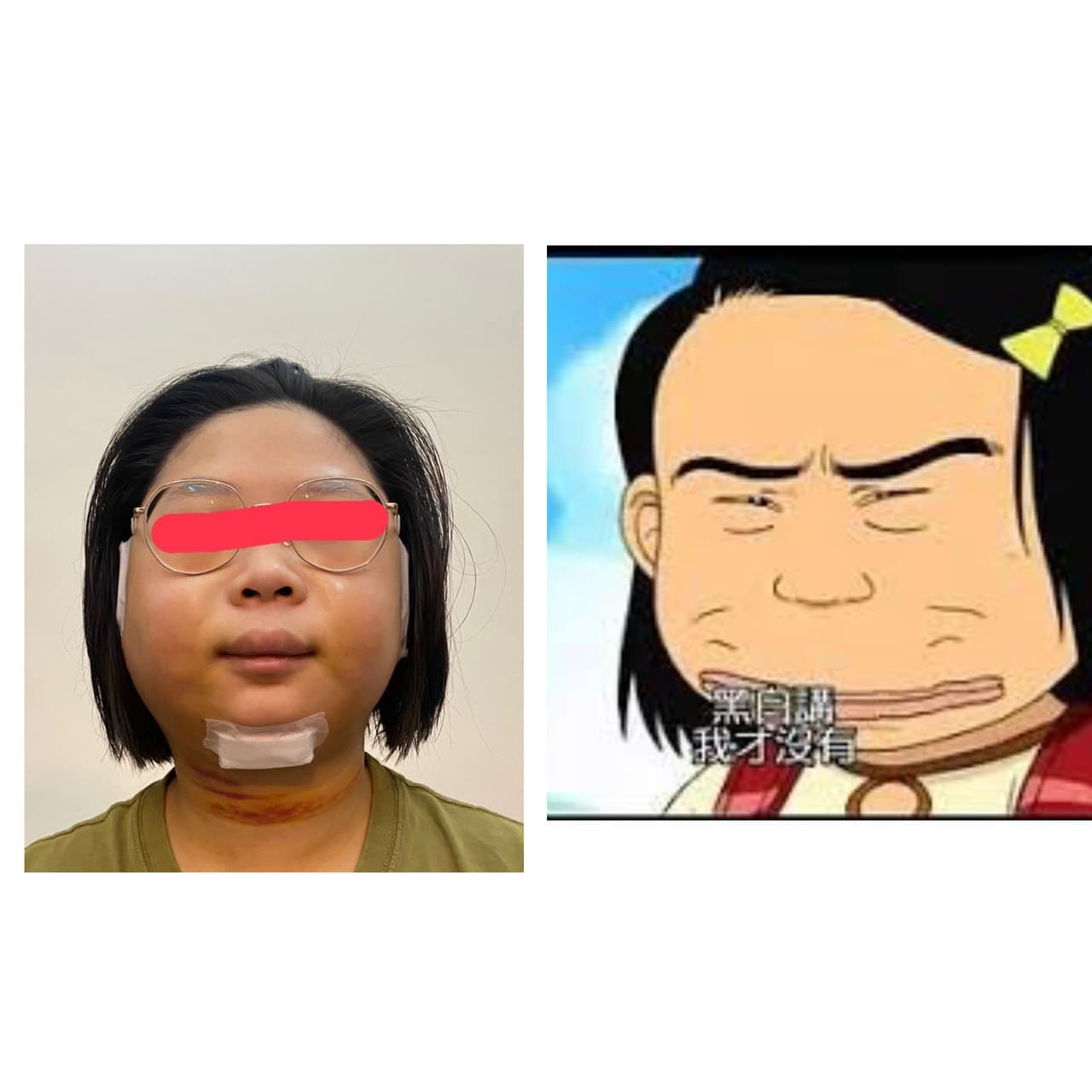 megapx