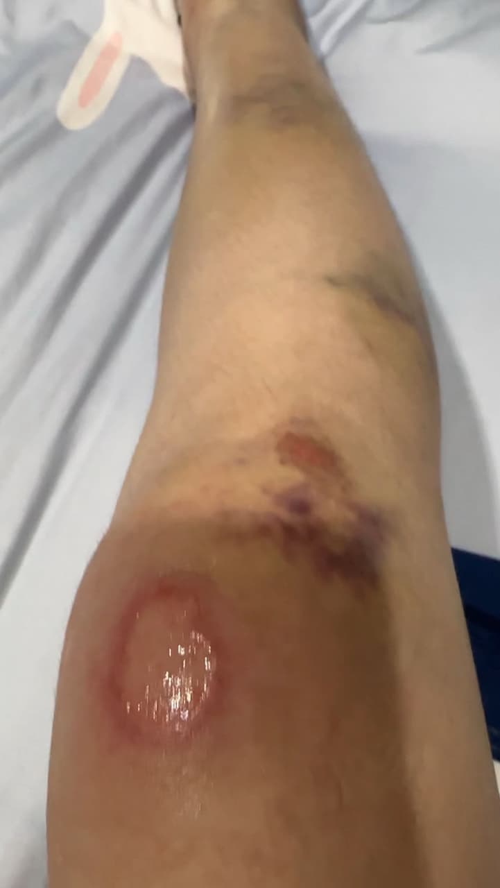 車禍和解的精選文章與討論｜Dcard